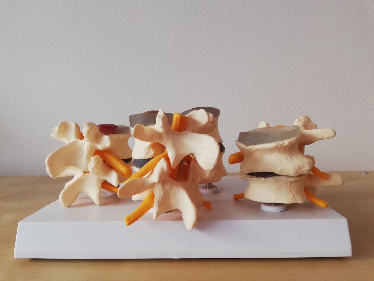 Modelle von einer Wirbelsäule